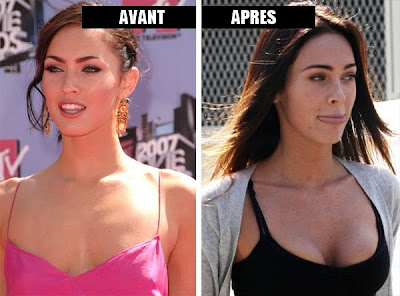 Megan Fox chirurgie esthetique