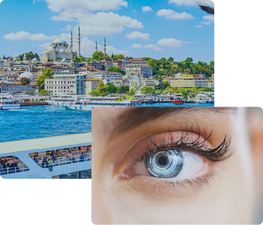 Keratopigmentaion Turkey - Eye color change price
